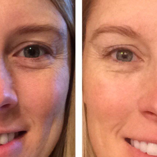 Original image from 6 Ways Drinking More Water Changes Your Life
